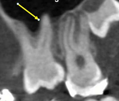 dvt-kfo-30.jpg